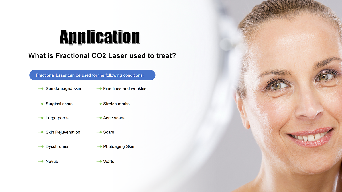 best-fractional-co2-laser-machine
