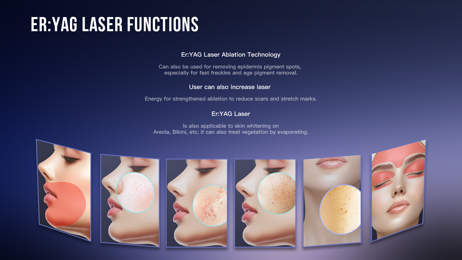 2940nm Erbium Yag Laser machine.jpg