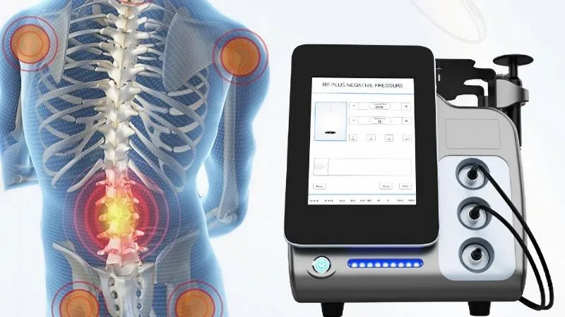 What is a CET RET RF Machine? An Introductory Guide for Aesthetic Clinics